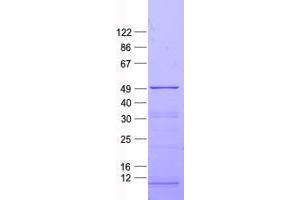 ZNF114 Protein (His tag)