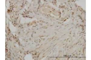 Immunoperoxidase of monoclonal antibody to DLX2 on formalin-fixed paraffin-embedded human ovary. (DLX2 抗体  (AA 1-110))