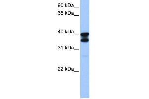 WB Suggested Anti-SLC25A31 Antibody Titration: 0. (SLC25A31 抗体  (N-Term))