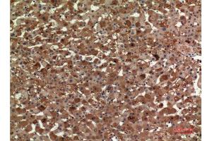 Immunohistochemistry (IHC) analysis of paraffin-embedded Human Liver, antibody was diluted at 1:100. (APOA1 抗体  (Internal Region))