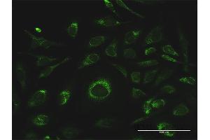 Immunofluorescence (IF) image for anti-Glutathione S-Transferase kappa 1 (GSTK1) (AA 1-226) antibody (ABIN531698)