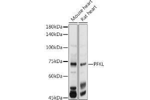 Western blot analysis of extracts of various cell lines, using PFKL antibody (ABIN7269308) at 1:1000 dilution. (PFKL 抗体  (AA 700-780))