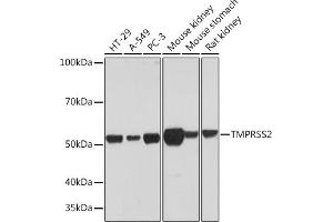 Western blot analysis of extracts of various cell lines, using TMPRSS2 Rabbit mAb (ABIN7270946) at 1:1000 dilution. (TMPRSS2 抗体)