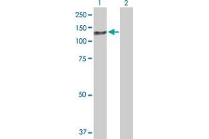 Western Blot analysis of ZCCHC8 expression in transfected 293T cell line by ZCCHC8 MaxPab polyclonal antibody. (ZCCHC8 抗体  (AA 1-707))