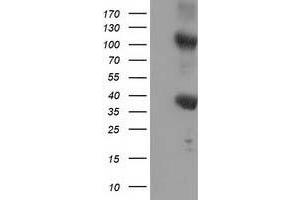 HEK293T cells were transfected with the pCMV6-ENTRY control (Left lane) or pCMV6-ENTRY ZFP36 (Right lane) cDNA for 48 hrs and lysed. (ZFP36 抗体)