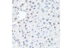 Immunohistochemistry of paraffin-embedded rat liver using HIST2H2BE antibody. (HIST2H2BE 抗体)