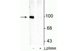 Western blot of rat hippocampal lysate showing specific immunolabeling of the ~100 kDa GluR1 protein phosphorylated at Ser831 in the first lane (-). (Glutamate Receptor 1 抗体  (pSer831))