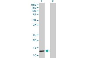Western Blot analysis of ABCC6 expression in transfected 293T cell line by ABCC6 MaxPab polyclonal antibody. (ABCC6 抗体  (AA 1-99))