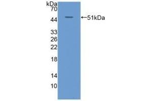 Detection of Recombinant KRT20, Human using Polyclonal Antibody to Cytokeratin 20 (CK 20) (KRT20 抗体  (AA 9-424))