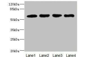 Western blot All lanes: IL21R antibody at 2. (IL21 Receptor 抗体  (AA 20-240))