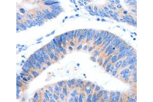 Immunohistochemistry (IHC) image for anti-Mucin 3A, Cell Surface Associated (MUC3A) antibody (ABIN2426702) (MUC3A 抗体)