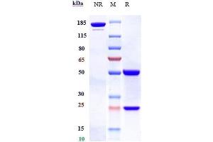 Anti-B7-H4 / VTCN1 Reference Antibody (alsevalimab) on SDS-PAGE under reducing (R) condition. (Recombinant B7-H4 (Alsevalimab Biosimilar) 抗体)