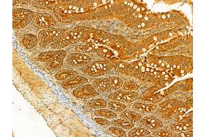 ABIN6263304 and ABIN6266596 at 1/100 staining Rat colon tissue by IHC-P. (MMP3 抗体  (C-Term))