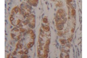 IHC-P analysis of Human Stomach Tissue, with DAB staining. (Cytokeratin 18 抗体  (AA 238-396))