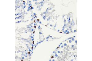 Immunohistochemistry (IHC) image for anti-SRY (Sex Determining Region Y)-Box 9 (SOX9) antibody (ABIN7270577)