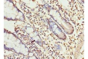 Immunohistochemistry of paraffin-embedded human small intestine tissue using ABIN7174649 at dilution of 1:100