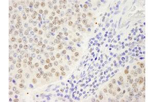 Immunohistochemistry (IHC) image for anti-Symplekin (SYMPK) (AA 1224-1274) antibody (ABIN7448822) (Symplekin 抗体  (AA 1224-1274))
