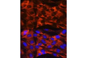 Immunofluorescence analysis of C6 cells using RPS19 Rabbit mAb (ABIN1681275, ABIN3017969, ABIN3017970 and ABIN7101552) at dilution of 1:100 (40x lens). (RPS19 抗体)