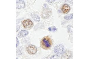 Immunohistochemistry (IHC) image for anti-Centromere Protein F (CENPF) (AA 2350-2400) antibody (ABIN7448938)