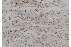 ABIN6257733 and ABIN6273708 at 1/100 staining Human lung tissue by IHC-P. (SYCP2 抗体  (Internal Region))