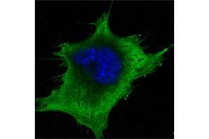 Immunofluorescence (IF) image for anti-Superoxide Dismutase 1, Soluble (SOD1) antibody (ABIN969412)
