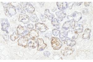 Immunohistochemistry (IHC) image for anti-Nucleoporin 50kDa (NUP50) (AA 418-468) antibody (ABIN7448703) (NUP50 抗体  (AA 418-468))