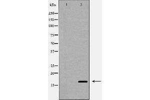Western blot analysis of Interleukin 4 expression in MCF-7 cells,The lane on the left is treated with the antigen-specific peptide. (IL-4 抗体  (Internal Region))
