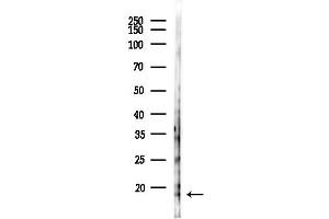 anti-Peroxiredoxin 5 (PRDX5) (C-Term) antibody