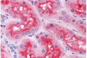 Human Kidney: Formalin-Fixed, Paraffin-Embedded (FFPE) (ACOT9 抗体  (AA 1-213))