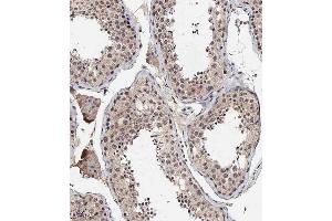 Immunohistochemical analysis of A on paraffin-embedded Human testis tissue. (BRD9 抗体  (N-Term))