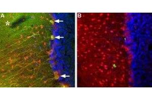 Immunohistochemistry (IHC) image for anti-Transient Receptor Potential Cation Channel, Subfamily C, Member 3 (TRPC3) (AA 822-835), (Intracellular) antibody (ABIN7043820)