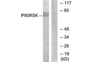 Western blot analysis of extracts from NIH-3T3 cells, treated with PMA 125ng/ml 30', using p90 RSK (Ab-573) Antibody. (RPS6KA3 抗体  (AA 539-588))
