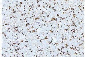 ABIN6277803 at 1/100 staining Mouse brain tissue by IHC-P. (ERBB3 抗体  (pTyr1289))