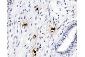 IHC analysis of Mast Cell Tryptase using anti-Mast Cell Tryptase antibody (ABIN4886754). (TPSAB1 抗体  (AA 65-275))