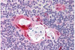 Human Thymus (formalin-fixed, paraffin-embedded) stained with TLR6 antibody ABIN214000 at 5 ug/ml followed by biotinylated goat anti-rabbit IgG secondary antibody ABIN481713, alkaline phosphatase-streptavidin and chromogen. (TLR6 抗体  (N-Term))