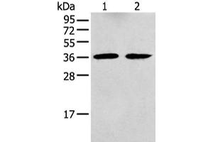 Western blot analysis of Mouse brain tissue and Human fetal brain tissue using GNAI2 Polyclonal Antibody at dilution of 1:400 (GNAI2 抗体)