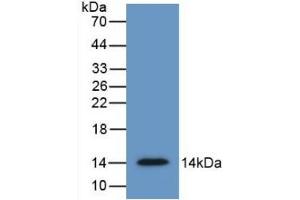 Detection of Recombinant SFRP4, Human using Monoclonal Antibody to Secreted Frizzled Related Protein 4 (SFRP4) (SFRP4 抗体  (AA 22-346))