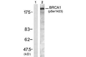 Image no. 1 for anti-Breast Cancer 1 (BRCA1) (pSer1423) antibody (ABIN273604) (BRCA1 抗体  (pSer1423))