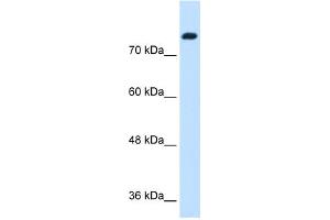 WB Suggested Anti-SNF1LK Antibody Titration:  1. (SIK1 抗体  (N-Term))