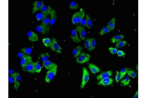 Immunofluorescent analysis of HepG2 cells using ABIN7169719 at dilution of 1:100 and Alexa Fluor 488-congugated AffiniPure Goat Anti-Rabbit IgG(H+L) (SLAMF1 抗体  (AA 69-204))