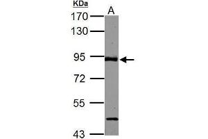 WB Image ABR antibody [C3], C-term detects ABR protein by Western blot analysis. (ABR 抗体  (C-Term))