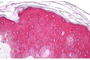 Anti-EPHA1 antibody IHC staining of human skin, epidermis. (EPHA1 抗体  (AA 913-943))