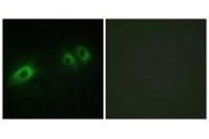 Immunofluorescence analysis of HeLa cells, using LAMB1 antibody. (Laminin beta 1 抗体  (C-Term))