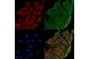 ABIN6257467 and ABIN6274784 staining Hela cells by IF/ICC.
