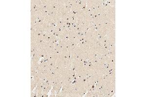 Immunohistochemical analysis of paraffin-embedded Human brain tissue using (ABIN651682 and ABIN2840359) performed on the Leica® BOND RXm. (USP17L24 抗体  (C-Term))