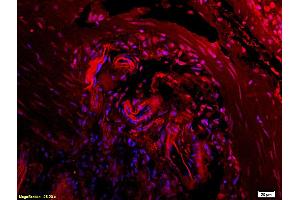 L1 rat kidney lysates L2 rat brain lysates probed with Anti CTHRC1 Polyclonal Antibody, Unconjugated (ABIN759281) at 1:200 in 4 °C. (CTHRC1 抗体  (AA 31-130))