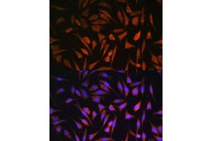 Immunofluorescence (IF) image for anti-Ral Guanine Nucleotide Dissociation Stimulator (RALGDS) antibody (ABIN7269838)