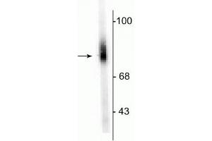 Western blot of human adrenal medulla lysate showing specific immunolabeling of the ~75 kDa DBH protein. (DBH 抗体  (N-Term))