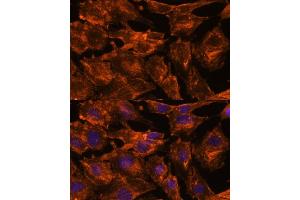 Immunofluorescence analysis of C6 cells using ITSN2 antibody (ABIN7268015) at dilution of 1:100. (Intersectin 2 抗体  (AA 500-620))