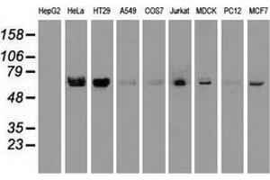Western blot analysis of extracts (35 µg) from 9 different cell lines by using anti-NTRK2 monoclonal antibody. (TRKB 抗体)